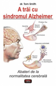 A trăi cu sindromul Alzheimer