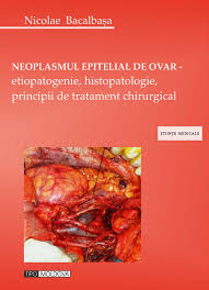 Neoplasmul epitelial de ovar : etiopatogenie, histopatologie, principii de tratament chirurgical